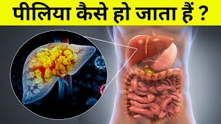 पीलिया कैसे हो जाता हैं  Jaundice pathophysiology [upl. by Mulloy]