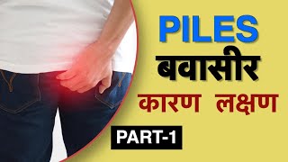 बवासीर के लक्षण क्या है  Dr Vasu  Piles symptoms in Hindi [upl. by Nary]