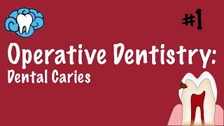 Operative Dentistry  Dental Caries  INBDE ADAT [upl. by Amethist]