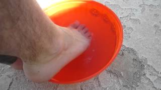 Best Athletes Foot Cure Chlorine Shock Treatment [upl. by Wallack]