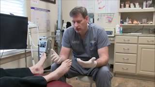 Treating Toenail Fungus with Lamisil [upl. by Norvin]