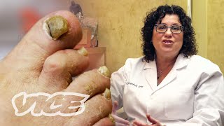 Meet a Toenail Fungus Expert [upl. by Emoraj]