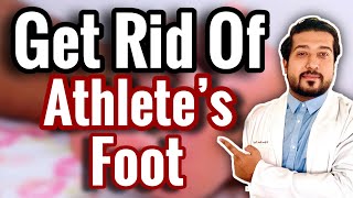 How to Treat Athletes Foot FOR GOOD 2021 [upl. by Tohcnarf]