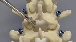 Medial Synovial Plica Test [upl. by Naloj]