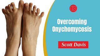 PDF Overcoming Onychomycosis [upl. by Nevah]