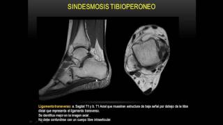 Anatomía de tobillo Resonancia M Parte 1 [upl. by Berliner986]