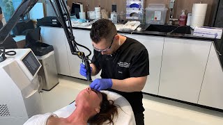 Ablative Erbium Laser for Skin Resurfacing  West Hollywood CA  Dr Jason Emer [upl. by Eileek]