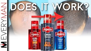 DOES CAFFEINE SHAMPOO WORK  Alpecin REVIEW amp Hair Growth Alternatives [upl. by Hadihahs]