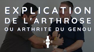 Explication de lArthrose ou Arthrite du Genou [upl. by Cash]