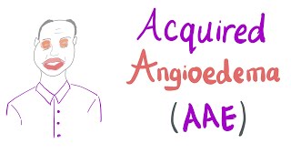 Acquired Angioedema AAE [upl. by Zednanreh842]