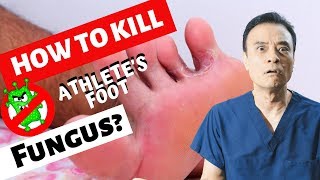 How to kill athletes foot fungus [upl. by Adirehs999]