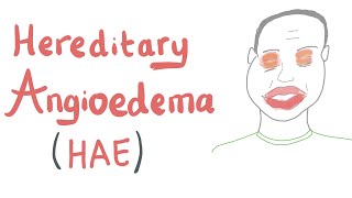 Hereditary Angioedema HAE [upl. by Ynittirb]