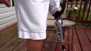 AmputeeOT How An Above Knee AK Prosthetic Leg Works [upl. by Noleta]