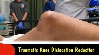 Traumatic Knee Dislocation ReductionQuick Version [upl. by Ymmit635]