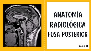 Anatomía Radiológica  Resonancia Magnética Fosa posterior [upl. by Roydd257]