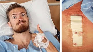 Hernia Mesh Surgery and Recovery Tips [upl. by Ideih13]