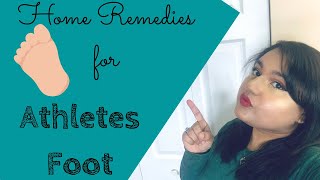 Home Remedies for Athletes Foot Treatment [upl. by Rhys]