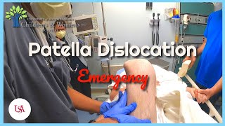 Patella Dislocation Emergency [upl. by Pentheas54]