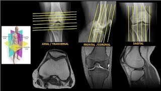 Resonancia Magnética de Rodilla Anatomía parte 1 [upl. by Nikolos]