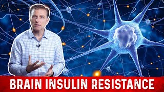 Dr Berg Explains Brain Insulin Resistance [upl. by Nosyk]