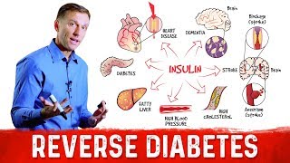 How to Reverse Damage from Diabetes – DrBerg on Reversing Diabetes [upl. by Engdahl893]