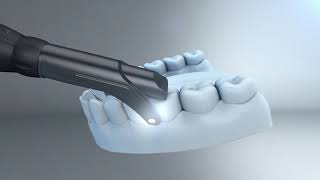 Welcome to DEXIS CariVu™ transillumination caries detection device [upl. by Ydroj]