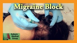 What to expect BOTOX® treatment for chronic migraines [upl. by Salhcin514]