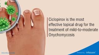 Ciclopirox is the most effective topical drug for the treatment of mildtomoderate Onychomycosis [upl. by Eissolf580]