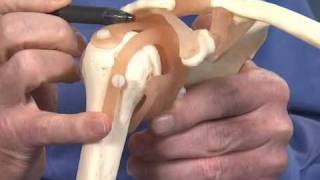 Shoulder Impingement  Dr Richard Hawkins [upl. by Welford]